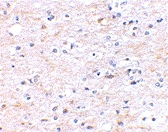 PAB13310 - FNBP1L