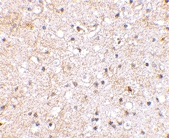 PAB13311 - Glutamate receptor 5 / GLUR5