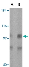 PAB13312 - Glutamate receptor 5 / GLUR5