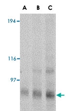 PAB13314 - Glutamate receptor KA1 / GRIK4