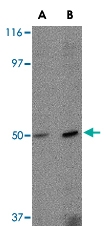 PAB13315 - Zygin-2