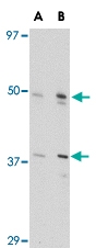 PAB13316 - Zygin-2