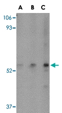 PAB13317 - SP110