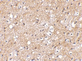 PAB13317 - SP110