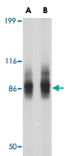 PAB13318 - SP110