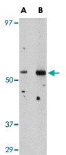 PAB13319 - PLXDC2 / TEM7R