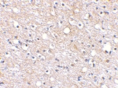 PAB13319 - PLXDC2 / TEM7R
