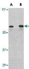 PAB13320 - PLXDC2 / TEM7R