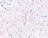 PAB13320 - PLXDC2 / TEM7R