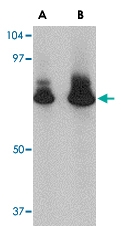PAB13323 - APG16L / ATG16L1