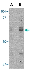 PAB13324 - APG16L / ATG16L1