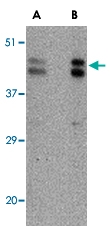 PAB13325 - FBXL20