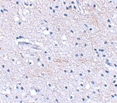 PAB13325 - FBXL20
