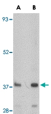 PAB13326 - FBXL20