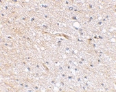 PAB13326 - FBXL20