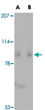 PAB13327 - SLITRK1
