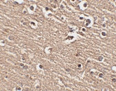 PAB13327 - SLITRK1