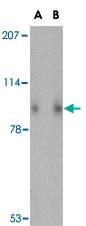 PAB13328 - SLITRK1