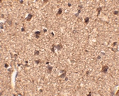 PAB13328 - SLITRK1