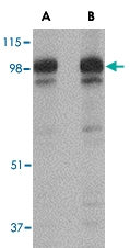 PAB13329 - SLITRK2