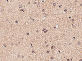 PAB13329 - SLITRK2