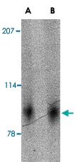 PAB13330 - SLITRK2