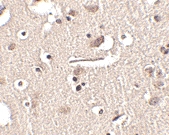 PAB13330 - SLITRK2