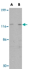 PAB13331 - SLITRK3