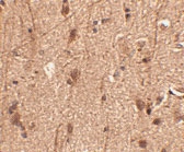 PAB13331 - SLITRK3