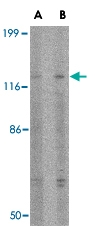 PAB13332 - SLITRK3