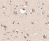 PAB13332 - SLITRK3