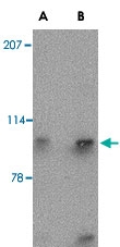 PAB13333 - SLITRK4