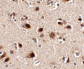 PAB13334 - SLITRK5