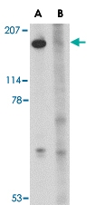 PAB13335 - SLITRK5