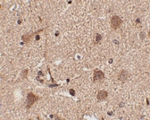 PAB13335 - SLITRK5
