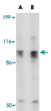 PAB13336 - SLITRK6