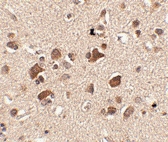 PAB13336 - SLITRK6
