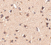 PAB13337 - SLITRK6
