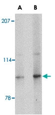 PAB13338 - SLITRK4