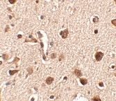 PAB13338 - SLITRK4