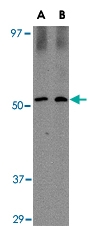 PAB13339 - SIRT2 / SIR2