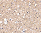 PAB13339 - SIRT2 / SIR2