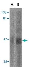 PAB13340 - SIRT2 / SIR2