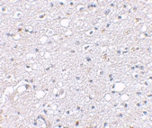 PAB13340 - SIRT2 / SIR2