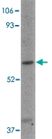 PAB13341 - LGI1 / EPT
