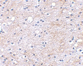 PAB13341 - LGI1 / EPT