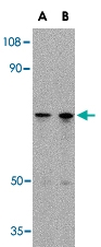 PAB13342 - LGI2