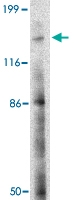 PAB13344 - BAIAP3