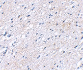 PAB13344 - BAIAP3