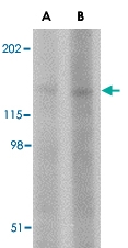 PAB13345 - BAIAP3
